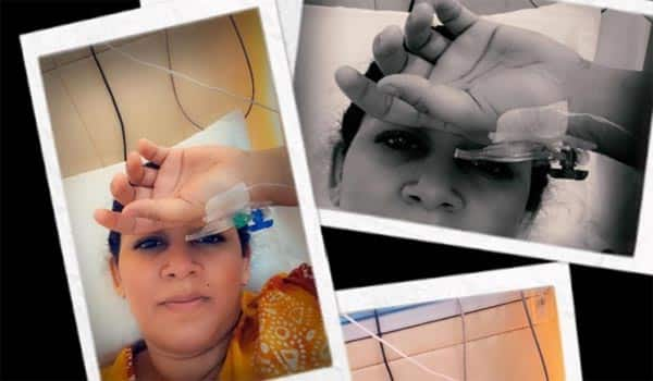 Archana-did-surgery-near-brain