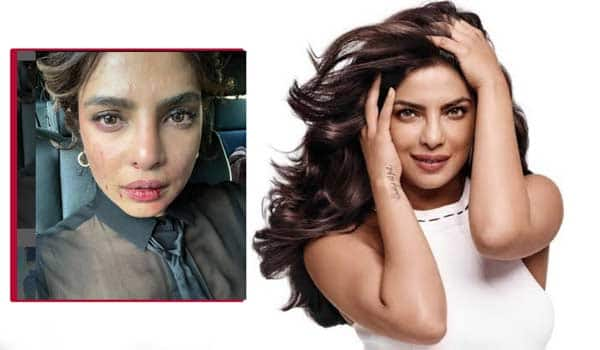 Is-Priyanka-chopra-injured-in-shooting