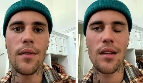 Justin-bieber-suffers-rare-disorder