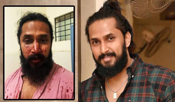 Brutal-attack-on-Kannada-hero