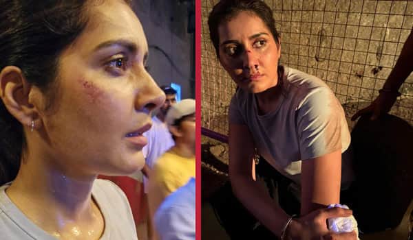 Raashi-Khanna-injured-during-filming