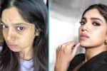 அரிய நோயால் பாதிக்கப்பட்டுள்ள பூமி பட்னேகர்