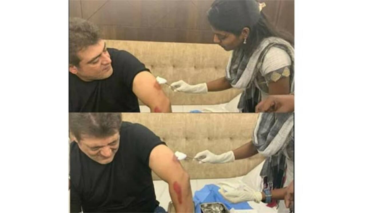 வலிமை-யின் போது அஜித்துக்கு ஏற்பட்ட காயம்  - வைரலான போட்டோ