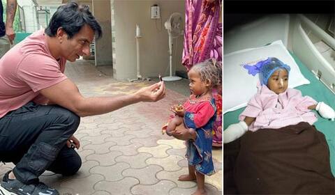 நான்கு கைகள், கால்களுடன் பிறந்த சிறுமிக்கு உதவிய சோனு சூட்