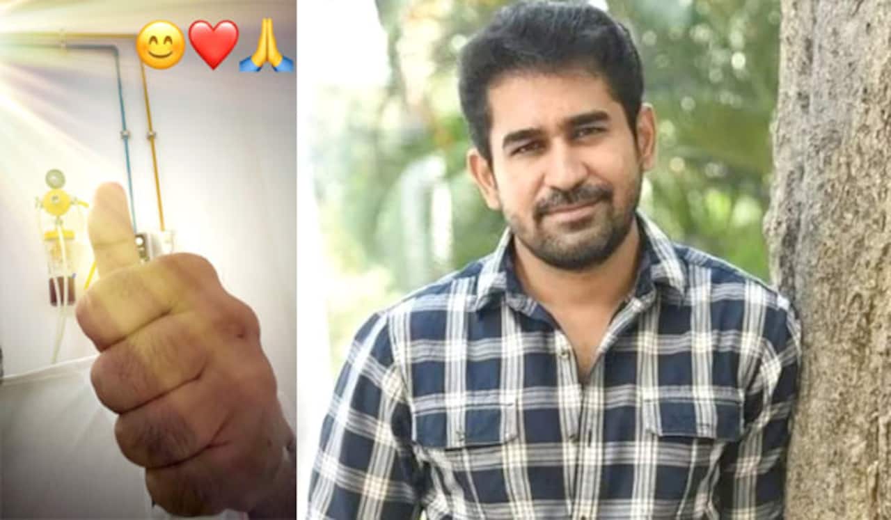 அறுவை சிகிச்சை முடிந்துள்ளது : விஜய் ஆண்டனியே வெளியிட்ட பதிவு