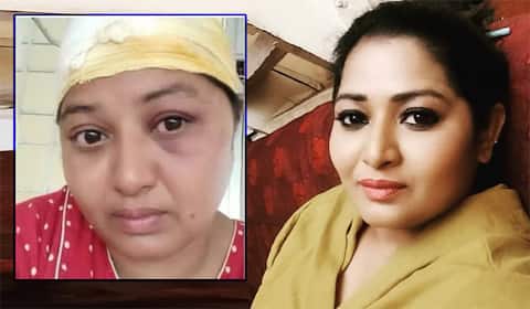 சொத்து பிரச்னையில் மோதல்: கன்னட நடிகை அனுகவுடா மண்டை உடைப்பு