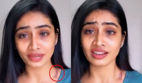 சீரியல் நடிகை சிவன்யாவுக்கு நேர்ந்த விபத்து : கழுத்தில் தழும்புடன் கண்ணீர் பேட்டி