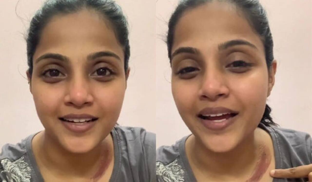 விபத்தில் சிக்கி மயிரிழையில் உயிர் தப்பிய வைஷாலி