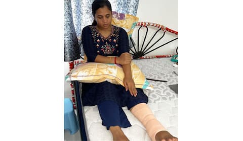 குக்வித் கோமாளி மணிமேகலைக்கு காலில் என்னாச்சு.?