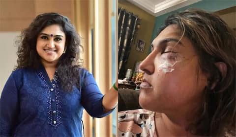 வனிதா மீது மர்ம நபர் தாக்குதல்: காயத்துடன் இருக்கும் படத்தால் பரபரப்பு
