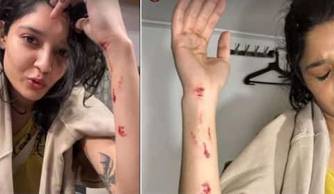 படப்பிடிப்பின் போது ரித்திகா சிங்கிற்கு கைகளில் காயம்