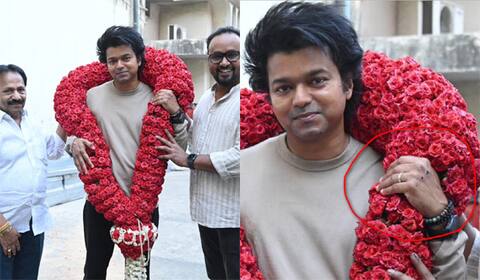 விஜய் கையில் காயம் : ரசிகர்கள் வருத்தம்