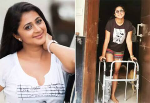 காலில் கட்டுடன் கனிகா! பதறிப்போன ரசிகர்கள்