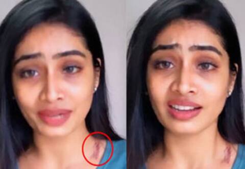 சீரியல் நடிகை சிவன்யாவுக்கு நேர்ந்த விபத்து : கழுத்தில் தழும்புடன் கண்ணீர் பேட்டி