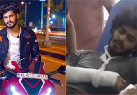விபரீதத்தில் முடிந்த வீலிங் சாகசம் : கை, கால்களில் காயம் : டிடிஎப் வாசன் மீது வழக்கு பதிவு