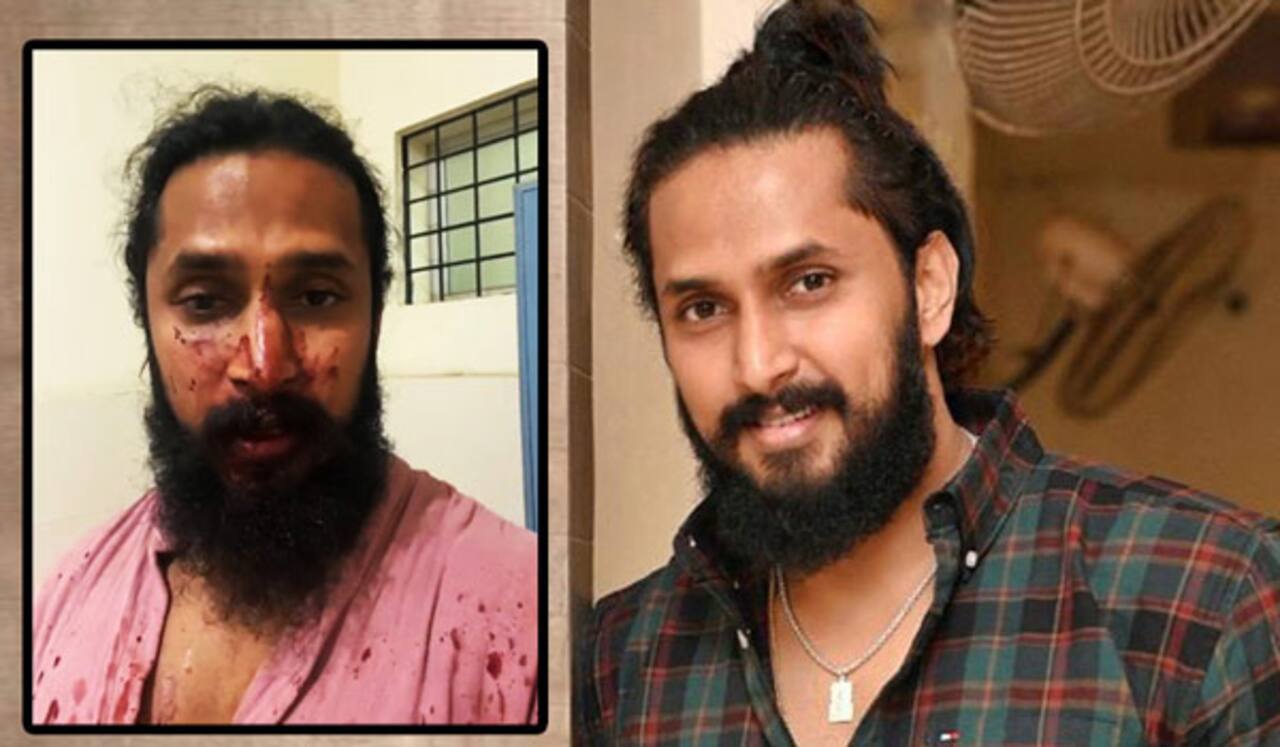 கன்னட ஹீரோ மீது கொடூர தாக்குதல்