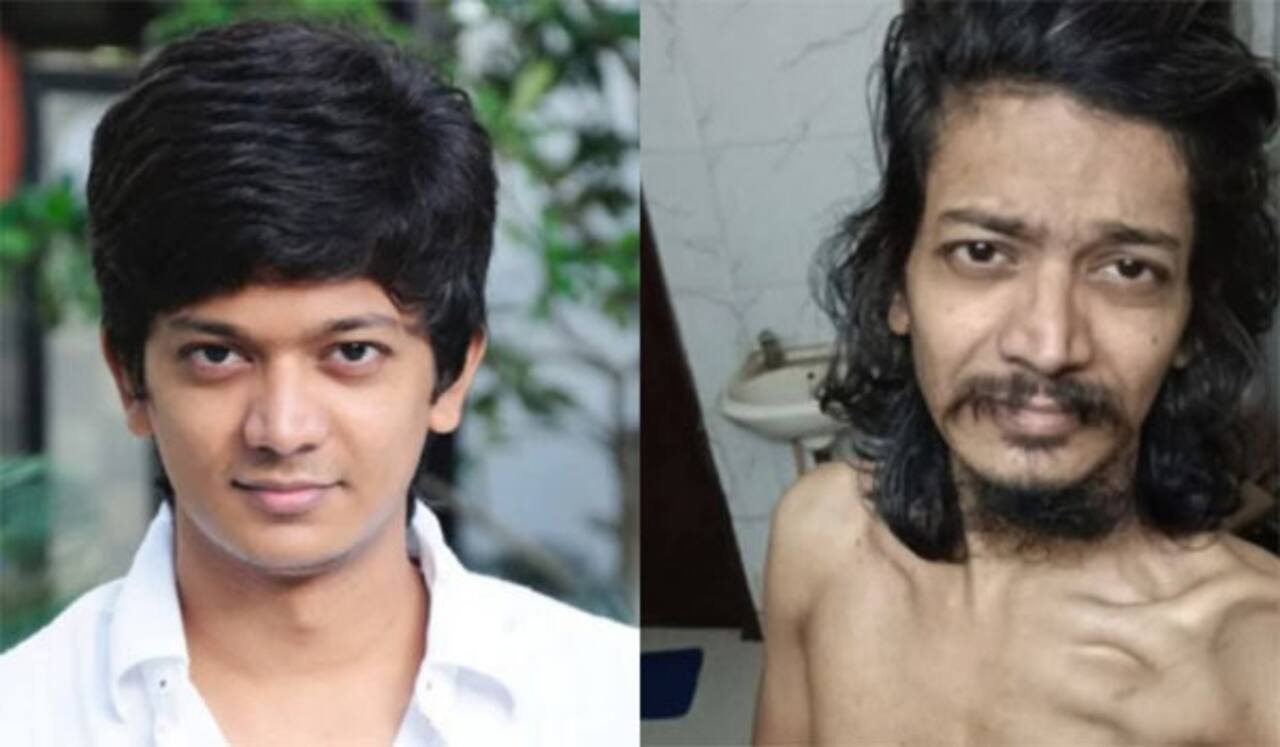 ஸ்ரீக்கு என்ன ஆச்சு? படத்தைப் பார்த்து அதிர்ச்சி அடைந்த ரசிகர்கள்