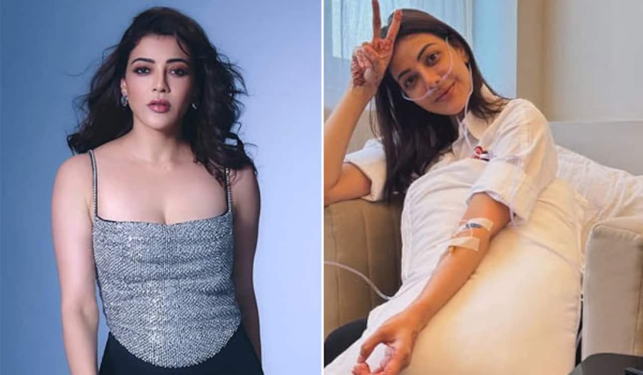 காஜல் அகர்வாலுக்கு என்னாச்சு...