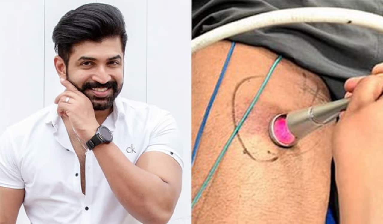 இருளன் படப்பிடிப்பில் அருண் விஜய் காயம்