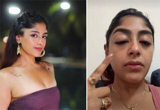 கிளப்பில் போதையில் கலாட்டா: இந்தி டிவி நடிகை மீது சரமாரி தாக்குதல்