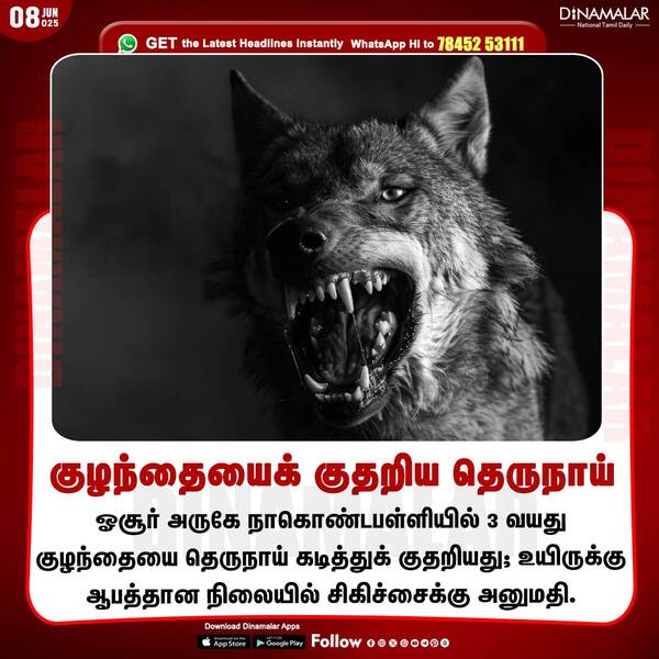 குழந்தையைக் குதறிய தெருநாய் 