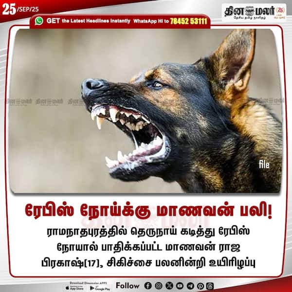 ரேபிஸ் நோய்க்கு மாணவன் பலி! 