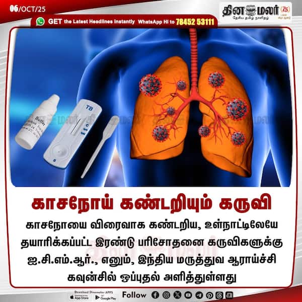 காசநோய் கண்டறியும் கருவி 