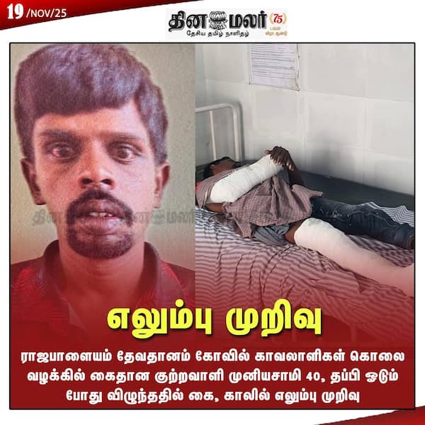 எலும்பு முறிவு 