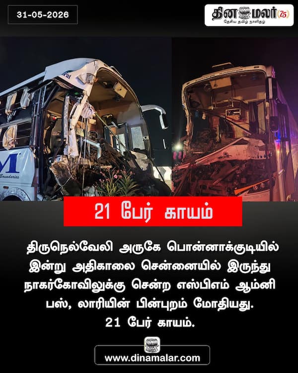 21 பேர் காயம் 