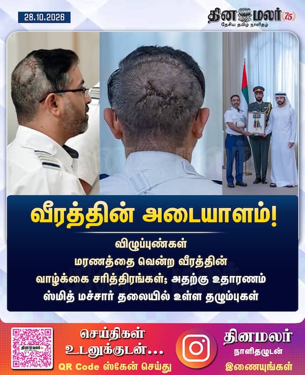 வீரத்தின் அடையாளம்! 