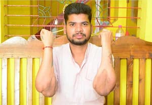  மாற்று கைகள்  பொருத்தியுள்ளேன்!