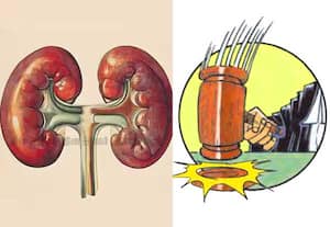 கிட்னி விற்பனை மோசடியில் யாருக்கு பொறுப்பு? மருத்துவமனை நழுவ முடியாது என்கிறது ஐகோர்ட்