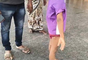 திருவள்ளூரில் தெரு நாய் கடித்து 6 வயது சிறுவன் பலத்த காயம்