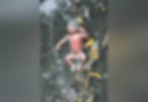 ﻿ பெண் சிசு சாக்கடையில் வீச்சு போலீஸ் தீவிர விசாரணை