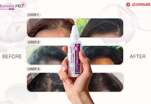 வீட்டு வைத்தியங்களை தாண்டி யோசிப்போம்: முடி உதிர்வுக்கு சரியான தீர்வு எது?