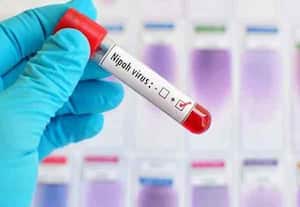 மேற்கு வங்கத்தில் செவிலியர் இருவருக்கு நிபா வைரஸ் அறிகுறி