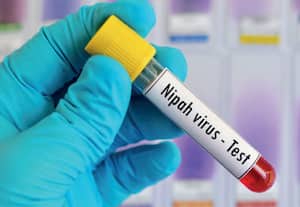 பதநீர், கள் அருந்துவதை தவிருங்கள்: 'நிபா வைரஸ்' பரவலை தடுக்க சுகாதாரத்துறை எச்சரிக்கை