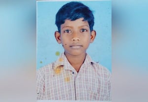  வளர்ப்பு நாய் குதறியதில் 10 வயது சிறுவன் காயம்