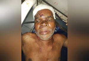  அடையாளம் தெரியாத முதியவருக்கு சிகிச்சை