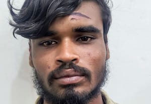  நாங்குநேரியை தொடர்ந்து இடைக்காட்டூர் பட்டியலினத்தவர்கள் மீது கொடூர தாக்குதல் 9 பேர் மீது வழக்கு; 5 பேரை கைது செய்தது போலீஸ்