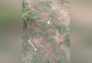  ஏரிக்கரையில் மண்டை ஓடு, எலும்புகள் பெங்களூரு புறநகரில் பதற்றம்