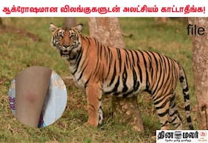புலியுடன் செல்பி எடுத்தபோது நகத்தில் கீறியது; தொற்றுக்கு ஆளான சிறுமி மரணத்தின் விளிம்பில் இருந்து மீட்பு