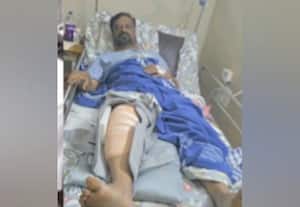  ஸ்கூட்டரில் சென்றவருக்கு காலில் எலும்பு முறிவு