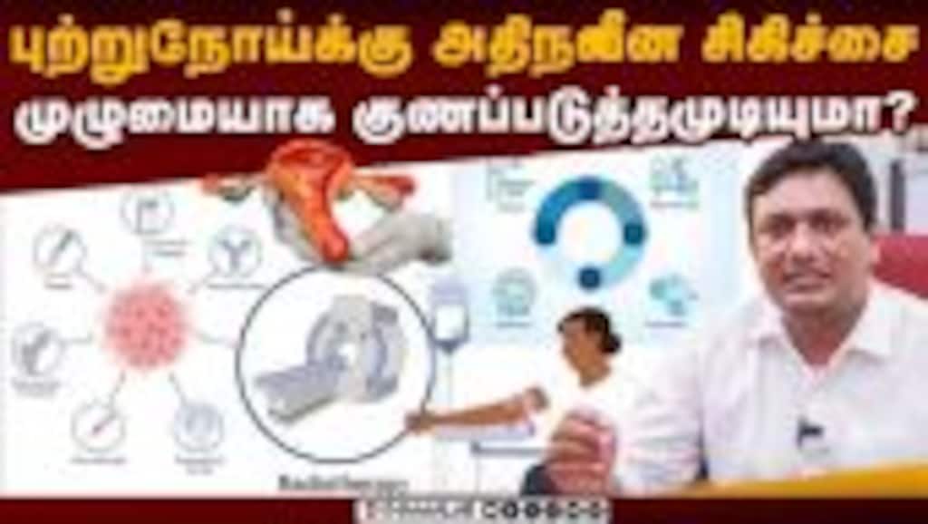புற்றுநோய்க்கு அதிநவீன சிகிச்சை முழுமையாக குணப்படுத்தமுடியுமா ? Kauvery Hospital