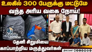 3 நாளில் வீடு திரும்பிய சிறுமி; மருத்துவர்கள் சாதனை  