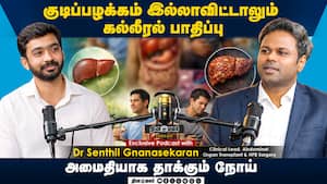 குடிப்பழக்கம் இல்லாவிட்டாலும் கல்லீரல் பாதிப்பு  