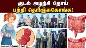 குடல் அழற்சி நோய் அறக்கட்டளை சார்பில் விழிப்புணர்வு கருத்தரங்கு! Colitis & Crohn's Foundation