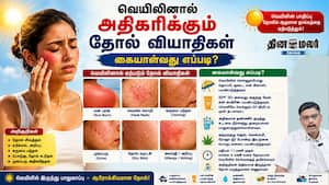வெயிலினால் அதிகரிக்கும் தோல் வியாதிகள் கையாள்வது எப்படி?