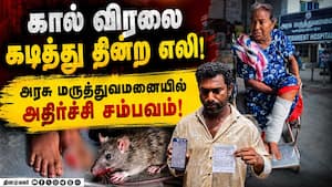 திருச்சி அரசு மருத்துவமனையில் நோயாளியின் கால் விரலை கடித்த எலி!  Trichy Government Hospital