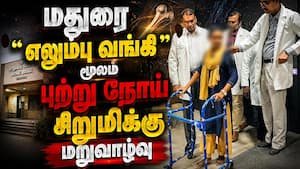 கால் வெட்டாமல் புற்று நோயை குணப்படுத்திய அரசு டாக்டர்கள்  